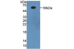 Detection of Recombinant bACE1, Human using Polyclonal Antibody to Beta-Site APP Cleaving Enzyme 1 (bACE1) (BACE1 Antikörper  (AA 170-428))