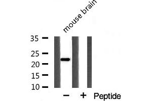 Western blot analysis of extracts from mouse Brian cells using PPIF antibody. (PPIF Antikörper  (Internal Region))
