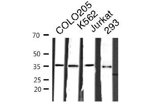 Western blot analysis of COLO205/K562/JURKAT/293 cell lysates using RNF113B antibody. (RNF113B Antikörper  (Internal Region))