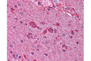 Immunohistochemistry (IHC) image for anti-Cholinergic Receptor, Nicotinic, beta 3 (Neuronal) (CHRNB3) (AA 176-225) antibody (ABIN6736369)