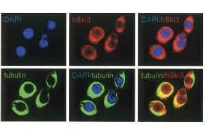 Immunofluorescence Microscopy of anti-SKI3 antibody Immunofluorescence Microscopy results of Rabbit anti-SKI3 antibody.