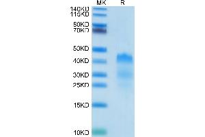 SDS-PAGE (SDS) image for RGM Domain Family, Member A (RGMA) (AA 48-422) protein (His-Avi Tag) (ABIN7275513)