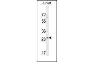 Western blot analysis of LRRC25 Antibody (C-term) in Jurkat cell line lysates (35ug/lane). (LRRC25 Antikörper  (C-Term))