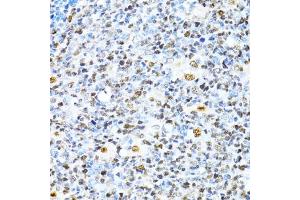 Immunohistochemistry (IHC) image for anti-X-Ray Repair Complementing Defective Repair in Chinese Hamster Cells 4 (XRCC4) (AA 1-336) antibody (ABIN3022382)