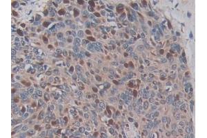 Immunohistochemistry (IHC) image for anti-ADAM Metallopeptidase Domain 17 (ADAM17) (AA 226-473) antibody (ABIN7426310)