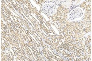 Immunohistochemical analysis of paraffin-embedded Human kidney section using Pink1 am2250b. (BBS4 Antikörper  (AA 1-240))