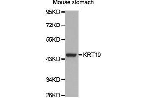 Western Blotting (WB) image for anti-Keratin 19 (KRT19) (AA 241-400) antibody (ABIN3020779) (Cytokeratin 19 Antikörper  (AA 241-400))