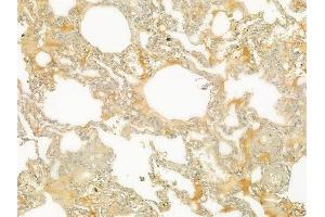 ABIN6265013 and ABIN6279108 at 1/100 staining human normal lung tissue by IHC-P. (alpha 2 Antiplasmin Antikörper  (C-Term))