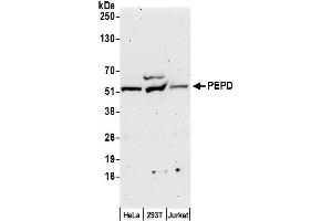 anti-Peptidase D (PEPD) (AA 443-493) antibody