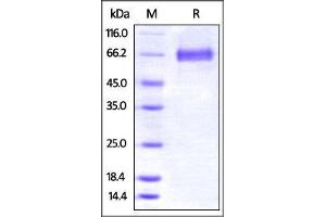 SDS-PAGE (SDS) image for Tumor Necrosis Factor (Ligand) Superfamily, Member 9 (TNFSF9) (AA 104-309) (Active) protein (Fc Tag) (ABIN2870709)