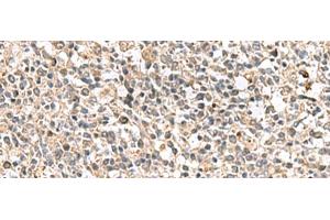 Immunohistochemistry of paraffin-embedded Human tonsil tissue using PTPRS Polyclonal Antibody at dilution of 1:110(x200)