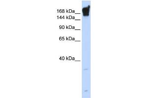 WB Suggested Anti-DYSF Antibody Titration:  0. (Dysferlin Antikörper  (Middle Region))