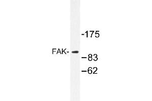 Image no. 1 for anti-PTK2 Protein tyrosine Kinase 2 (PTK2) antibody (ABIN272099) (FAK Antikörper)
