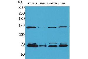 Western Blotting (WB) image for anti-K-Cadherin (CDH6) (Internal Region) antibody (ABIN3187664)