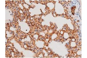 Immunohistochemistry (IHC) image for anti-Spleen tyrosine Kinase (SYK) (pTyr525) antibody (ABIN6255944)
