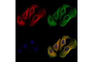 ABIN7094587 and ABIN7098636 staining Hela cells by IF/ICC.