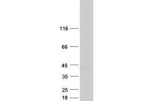 Western Blotting (WB) image for DIM1 Dimethyladenosine Transferase 1 Homolog (DIMT1) protein (Myc-DYKDDDDK Tag) (ABIN2719491)