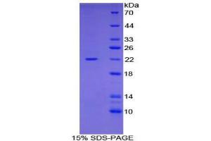 SDS-PAGE (SDS) image for Cofilin 1 (CFL1) (AA 3-161) protein (His tag) (ABIN1879620)