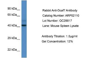 Western Blotting (WB) image for anti-DDB1 and CUL4 Associated Factor 7 (DCAF7) (N-Term) antibody (ABIN2784780) (DCAF7 Antikörper  (N-Term))