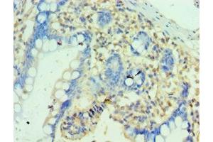 Immunohistochemistry of paraffin-embedded human small intestine tissue using ABIN7162868 at dilution of 1:100 (PTRH2 Antikörper  (AA 40-179))