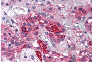 Human Adrenal (formalin-fixed, paraffin-embedded) stained with GRIK1 antibody ABIN343898 at 5 ug/ml followed by biotinylated goat anti-rabbit IgG secondary antibody ABIN481713, alkaline phosphatase-streptavidin and chromogen. (GRIK1 Antikörper  (Internal Region))