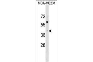 Western blot analysis in MDA-MB231 cell line lysates (35ug/lane). (ABO Antikörper  (N-Term))