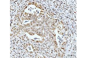 IHC analysis of 53BP1/TP53BP1 using anti-53BP1/TP53BP1 antibody (ABIN7599869). (TP53BP1 Antikörper  (AA 1239-1972))