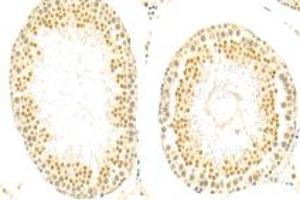 Immunohistochemistry analysis of paraffin-embedded rat testis using,SIN1 (ABIN7074669) at dilution of 1: 500