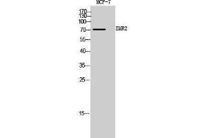 Western Blotting (WB) image for anti-Egf-Like Module Containing, Mucin-Like, Hormone Receptor-Like 2 (EMR2) (Internal Region) antibody (ABIN3188026) (EMR2 Antikörper  (Internal Region))