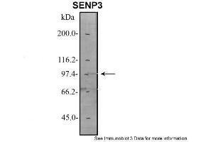 Sample Type: 1. (SENP3 Antikörper  (N-Term))