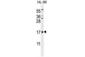 CNIH2 Antibody (N-term) western blot analysis in HL-60 cell line lysates (35µg/lane).