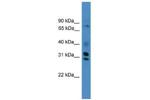 WB Suggested Anti-GIPC3 Antibody Titration:  0. (GIPC3 Antikörper  (Middle Region))