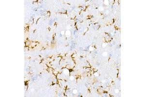 Immunohistochemistry of paraffin-embedded Rat brain using /IB antibody (ABIN7265554) at dilution of 1:100 (40x lens). (Iba1 Antikörper)