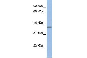 WB Suggested Anti-EMID1 Antibody Titration:  0. (EMID1 Antikörper  (C-Term))