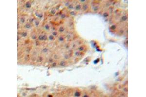 Used in DAB staining on fromalin fixed paraffin-embedded Liver tissue (IL-20 Antikörper  (AA 25-176))