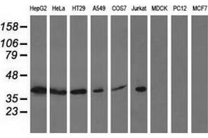 Western blot analysis of extracts (35 µg) from 9 different cell lines by using anti-ACAT2 monoclonal antibody. (ACAT2 Antikörper)