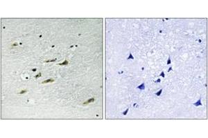 Immunohistochemistry analysis of paraffin-embedded human brain tissue, using JAK2 (Ab-931) Antibody. (JAK2 Antikörper  (AA 906-955))