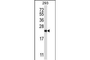 Western blot analysis in 293 cell line lysates (35ug/lane). (RAB1B Antikörper  (C-Term))