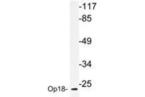 Western blot analyzes of Op18 antibody in extracts from HepG2 cells. (Stathmin 1 Antikörper)