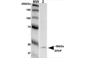 Western Blot analysis of Rat Brain Membrane showing detection of GFAP protein using Mouse Anti-GFAP Monoclonal Antibody, Clone S206A-8 . (GFAP Antikörper  (AA 411-422) (Biotin))
