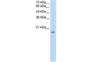 WB Suggested Anti-EDG8 Antibody Titration:  2. (S1PR5 Antikörper  (N-Term))