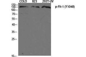 Western Blotting (WB) image for anti-Fms-Related tyrosine Kinase 1 (VEGFR1) (FLT1) (pTyr1048) antibody (ABIN3179813) (FLT1 Antikörper  (pTyr1048))
