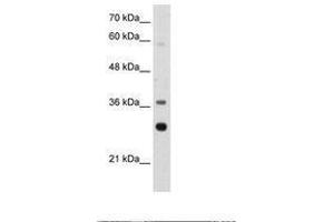 Image no. 1 for anti-Ribosomal Protein, Large, P0 (RPLP0) (AA 182-231) antibody (ABIN203302) (RPLP0 Antikörper  (AA 182-231))