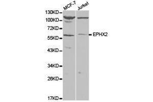 Western Blotting (WB) image for anti-Epoxide Hydrolase 2, Cytoplasmic (EPHX2) antibody (ABIN1872559) (EPHX2 Antikörper)