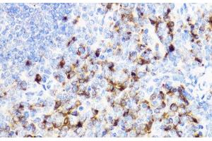 Immunohistochemistry of paraffin-embedded Mouse spleen using YKL-40 / CHI3L1 Polyclonal Antibody at dilution of 1:100 (40x lens). (CHI3L1 Antikörper)