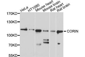 Western blot analysis of extracts of various cell lines, using CORIN antibody (ABIN5997494) at 1/1000 dilution. (Corin Antikörper)