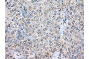 Immunohistochemical staining of paraffin-embedded Human colon tissue using anti-SNX9 mouse monoclonal antibody. (SNX9 Antikörper)