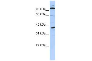 WB Suggested Anti-PHF11 Antibody Titration:  0. (PHF11 Antikörper  (N-Term))