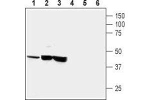 Western blot analysis of human neuroblastoma (SH-SY5Y) (lanes 1 and 4), human brain astrocytoma (CCF-STTGI) (lanes 2 and 5) and rat pheochromocytoma (PC12) (lanes 3 and 6): - 1-3. (CRHR1 Antikörper  (Extracellular, N-Term))