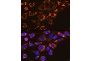 Immunofluorescence analysis of NIH-3T3 cells using F Rabbit mAb (ABIN1682600, ABIN3018533, ABIN3018534 and ABIN7101623) at dilution of 1:100 (40x lens). (FAAH Antikörper)